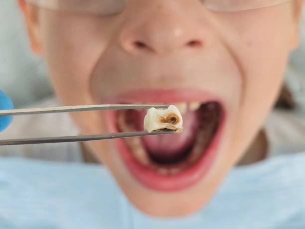 Best Orthodontic Emergency Dentist in Fairview Park, IN